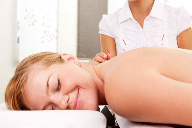 Woman smiling with thin acupuncture needles being placed in her back